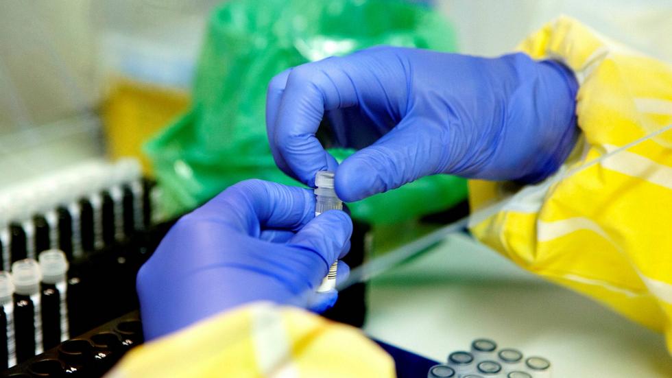 Trycket på regionens labbpersonal har ökat under pandemin. Nu larmar facket om att 39 biomedicinska analytiker har sagt upp sig i år och förra året. 