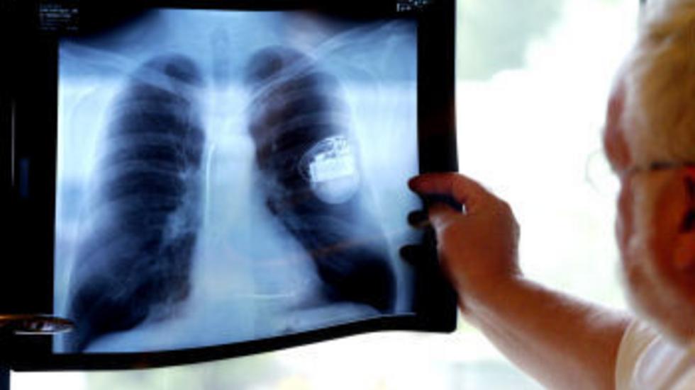 Patienter har fått en förhöjd stråldos i samband med röntgen vid insättning av pacemaker på Länssjukhuset Ryhov. OBS! Bilden är en genrebild. 