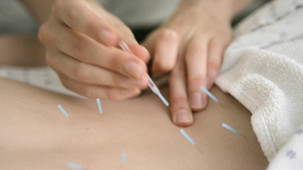 Det uppmärksammade fallet med en man som avled efter en behandling med akupunktur får nu en fortsättning i hovrätten. I tingsrätten friades akupunktören från grovt vållande till annans död. Foto: AP Photo