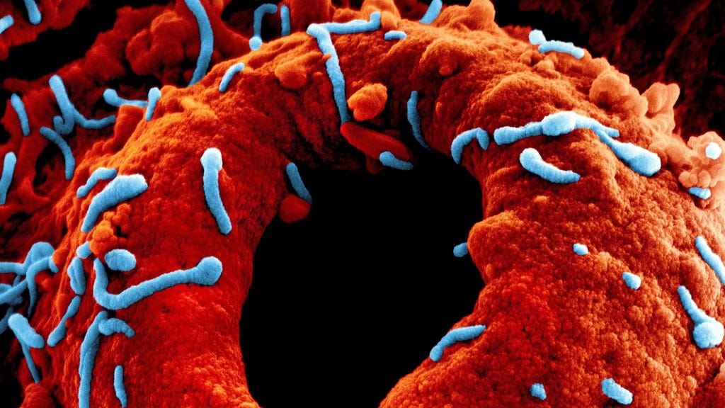 La causa dell'eruzione di Marburg è stata determinata