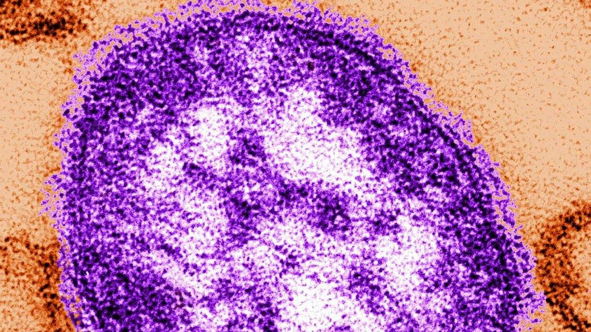 Measles cases challenge Swedish vaccination model