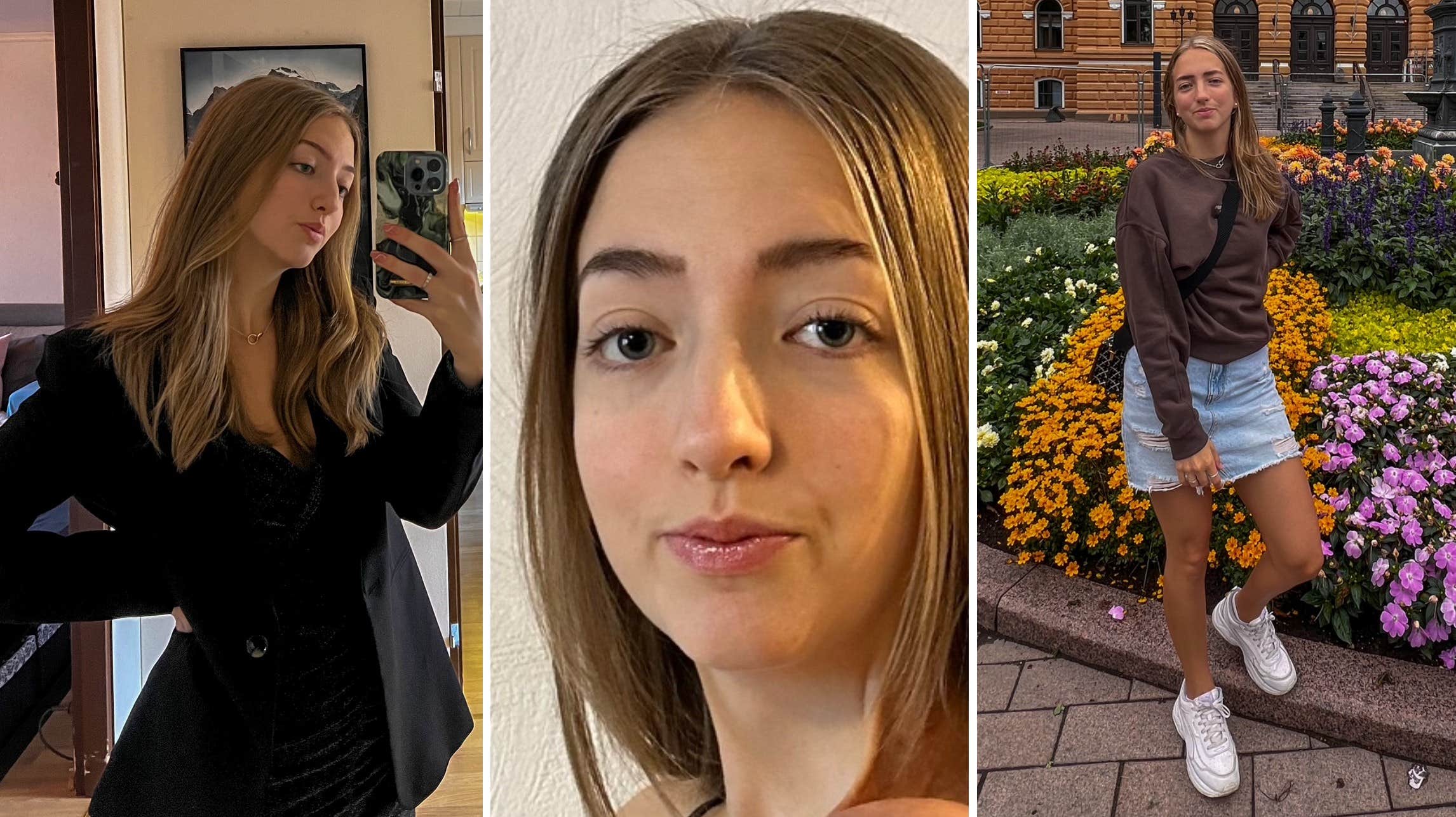 Finlandssvenska Tracey, 21, föddes med farliga födelsemärket