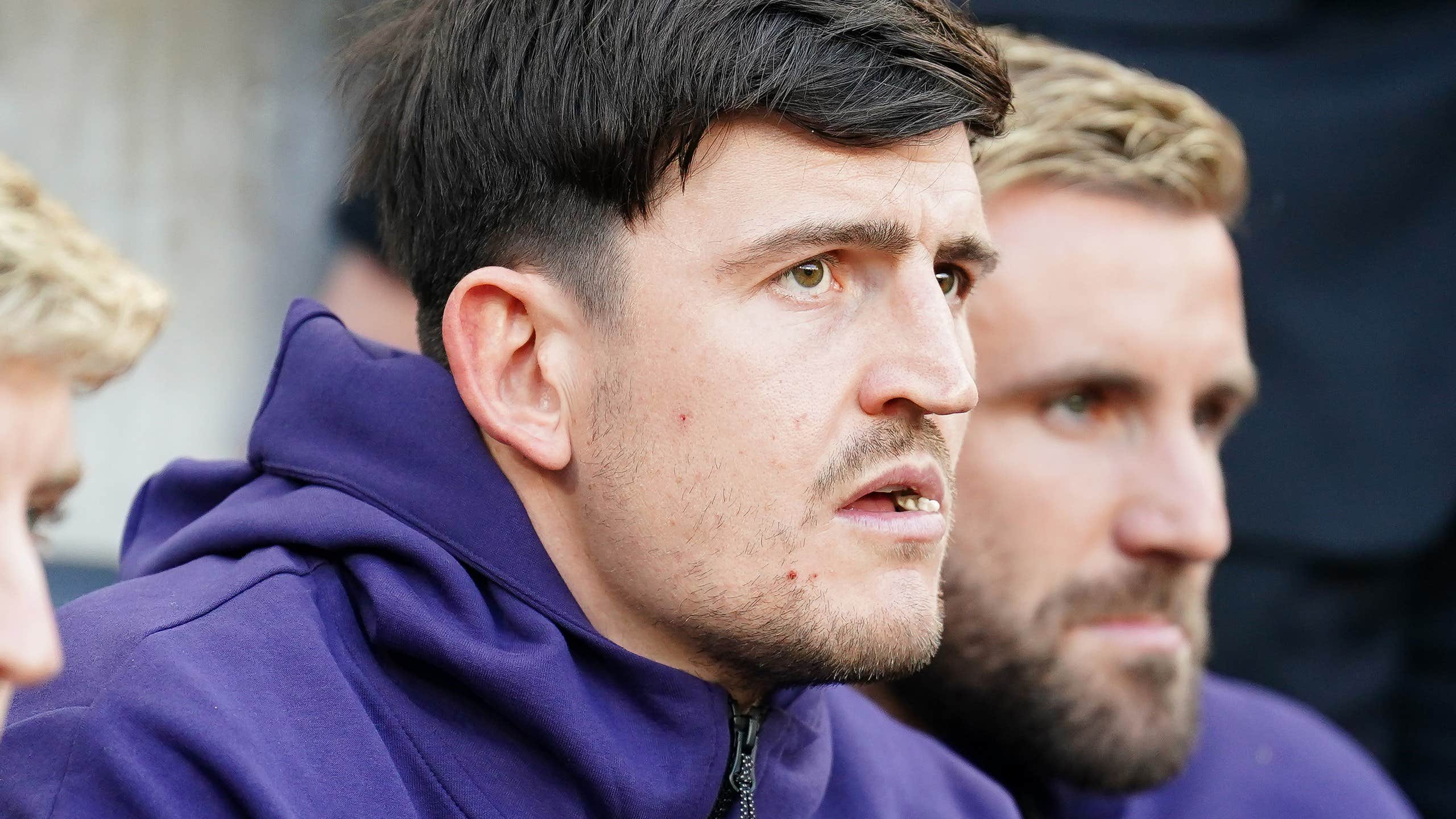 Harry Maguire öppnar upp om jobbiga skadan | Premier League | Expressen